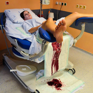 Peripartální život ohrožující krvácení - 2013 Anotační obrázek