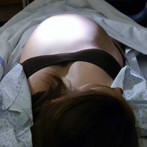Resuscitation of pregnant woman