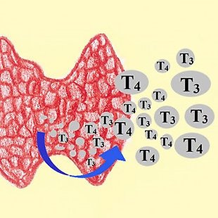 Thyreotoxicosis