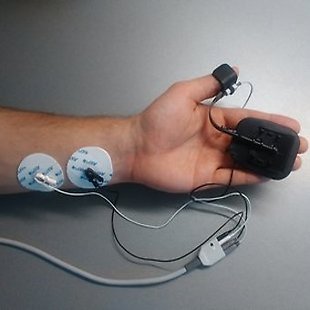 Neuromuscular Blockade Monitoring Annotation image