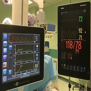 Hemodynamický monitoring Anotační obrázek