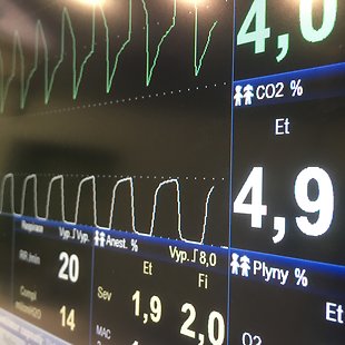 Capnography Annotation image