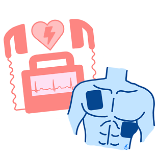 Pulse ventricular tachycardia