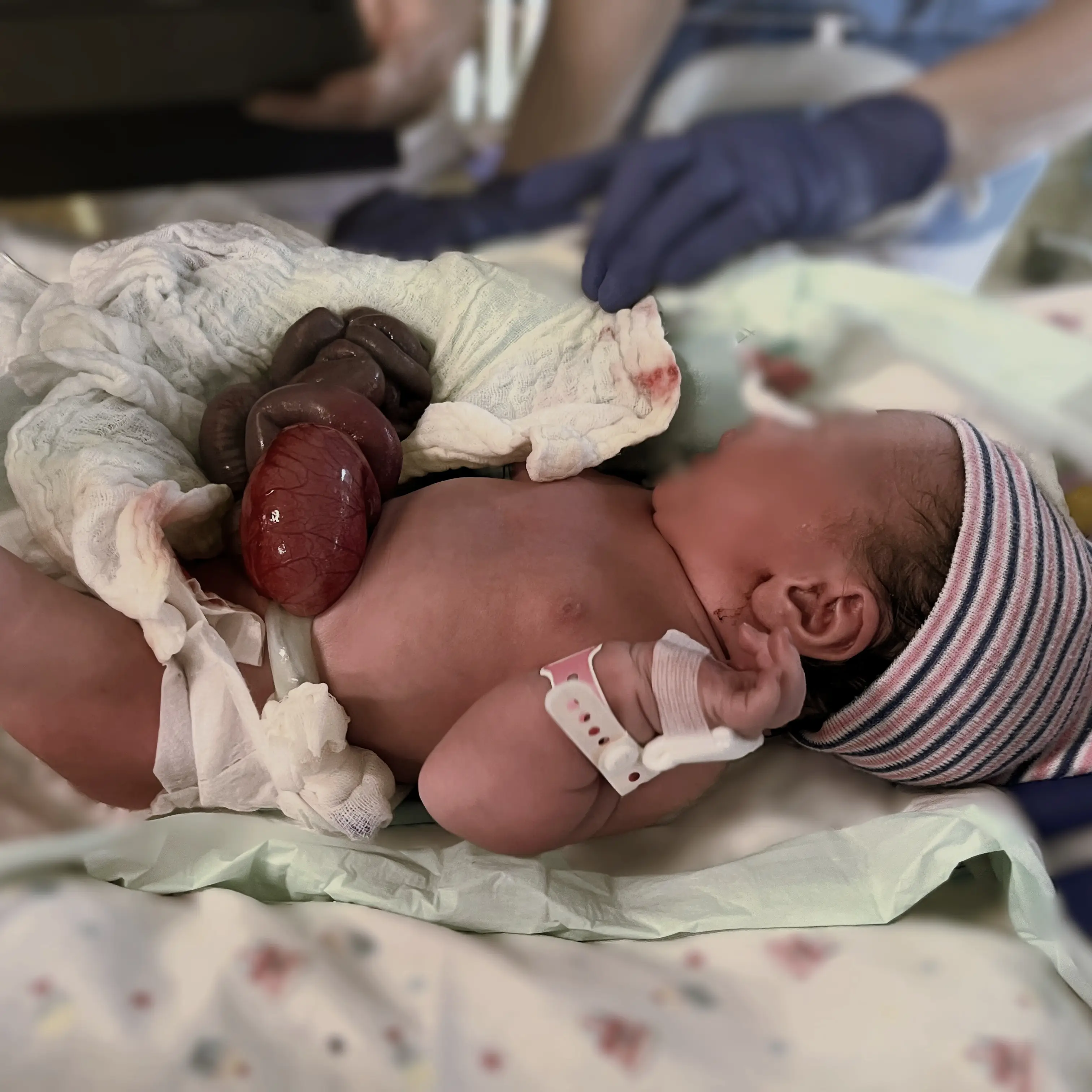 Anesthesia in premature infants